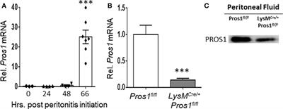 Macrophage-Derived Protein S Facilitates Apoptotic Polymorphonuclear Cell Clearance by Resolution Phase Macrophages and Supports Their Reprogramming